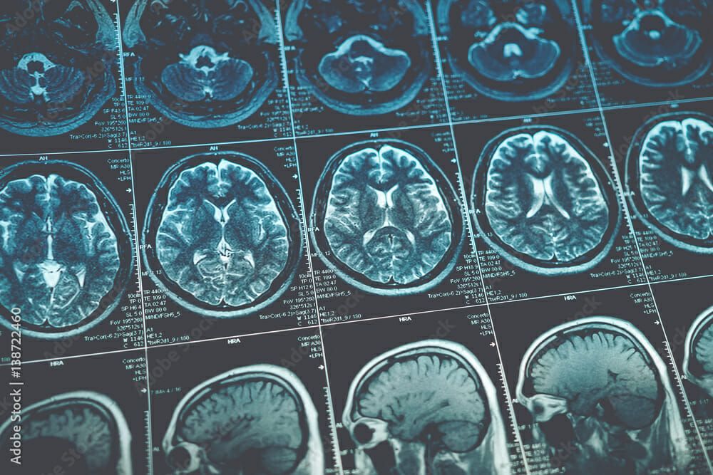 Brain MRI scans background
